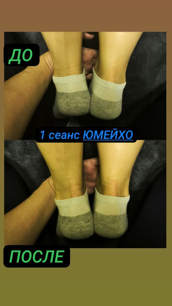 Приглашаю на новый вид массажа Юмейхо